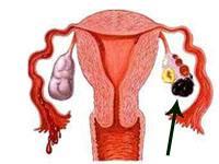 第二胎想要个男孩怎么办？哪些方法能增加生男孩的机会？