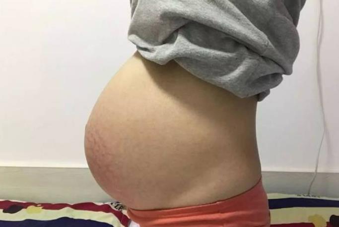 泰国曼谷BIC中心哪个医生做羊角子宫怀孕成功率高？